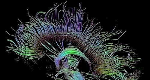 صورة لـ 5 أدوات مفيدة لمساعدتك على تمييز الأخبار الوهمية والمزيفة | fake-news-brain-DzTechs