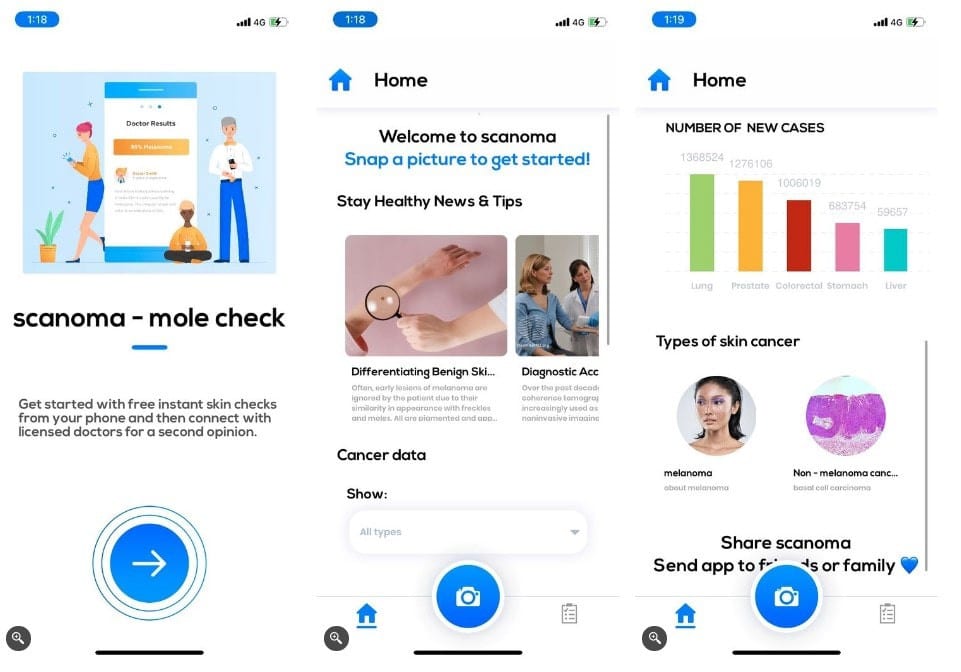 صورة لـ هل واجهتَ بُقعة غريبة على بشرتك؟ إليك أفضل تطبيقات الأمراض الجلدية لتشخيصها | 1cYblq1h3djYLhhLm3WAiCg-DzTechs
