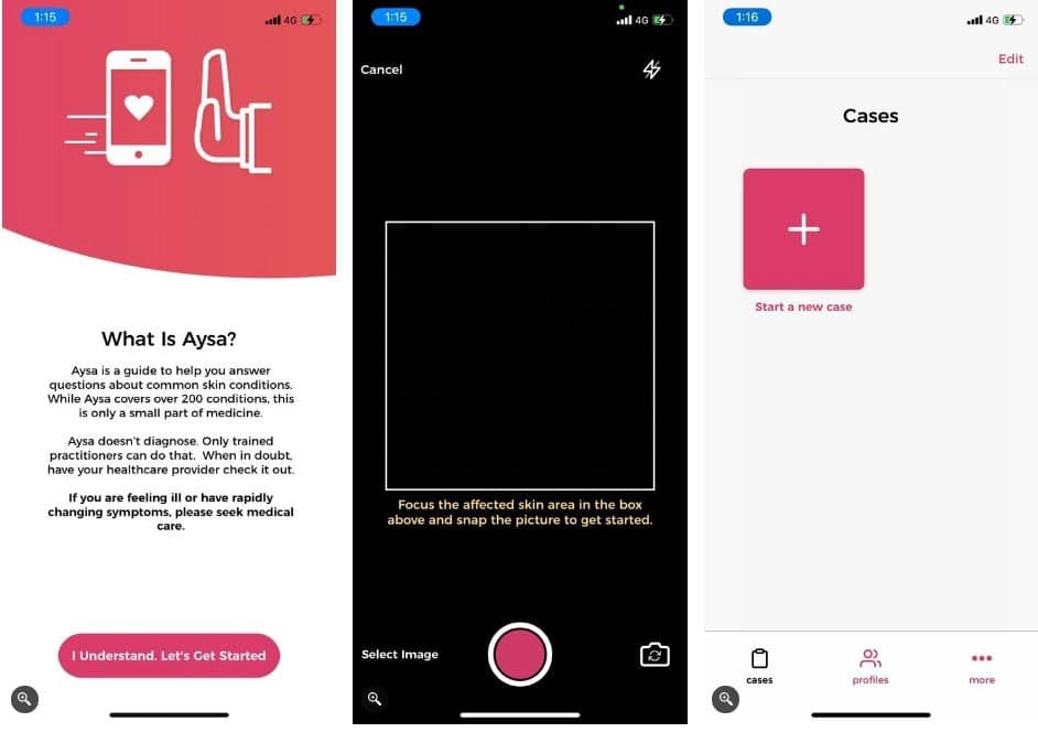 صورة لـ هل واجهتَ بُقعة غريبة على بشرتك؟ إليك أفضل تطبيقات الأمراض الجلدية لتشخيصها | 1pEBztzUm9Ybm1kt-9v0iNw-DzTechs